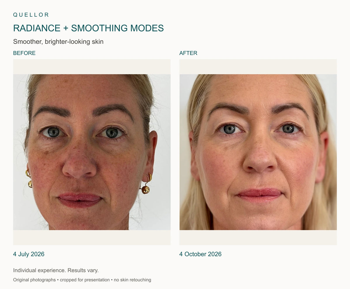 Radiance and Smoothing modes before and after, 4 July and 4 October 2026.