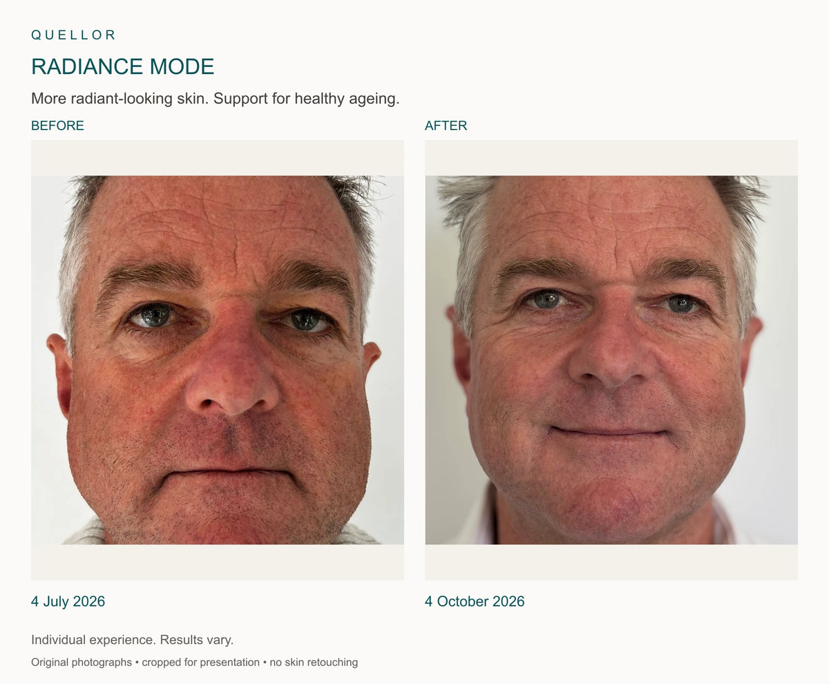 Radiance Mode before and after, 4 July and 4 October 2026.